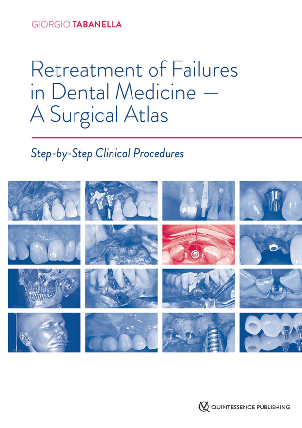 Retreatment of Failures in Dental Medicine – A Surgical Atlas: Step-by-Step Clinical Procedures