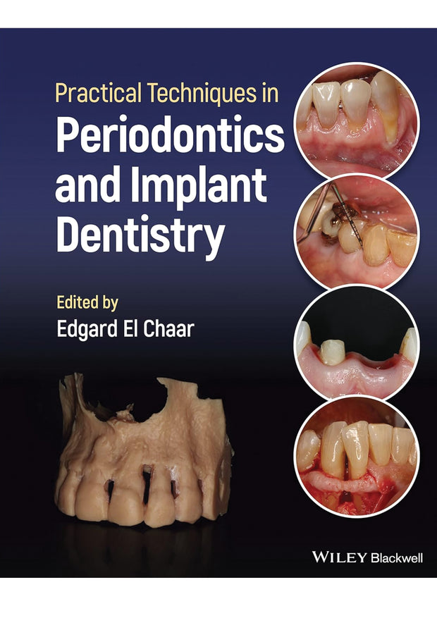 Practical Techniques in Periodontics and Implant Dentistry 1st Edition