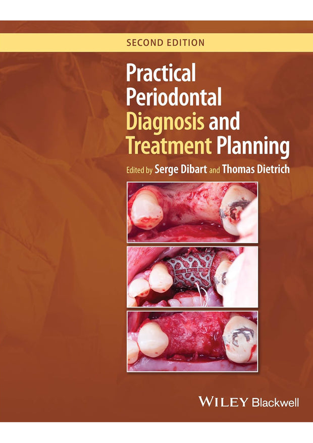 Practical Periodontal Diagnosis and Treatment Planning, 2nd Edition