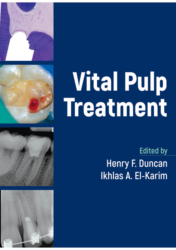 Vital Pulp Treatment