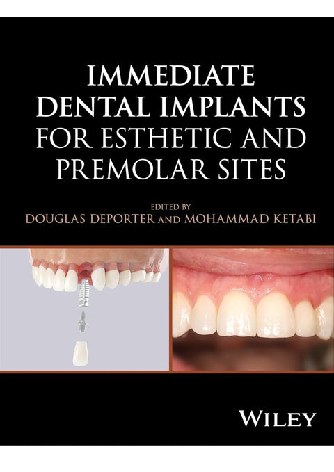 Immediate Dental Implants for Esthetic and Premolar Sites
