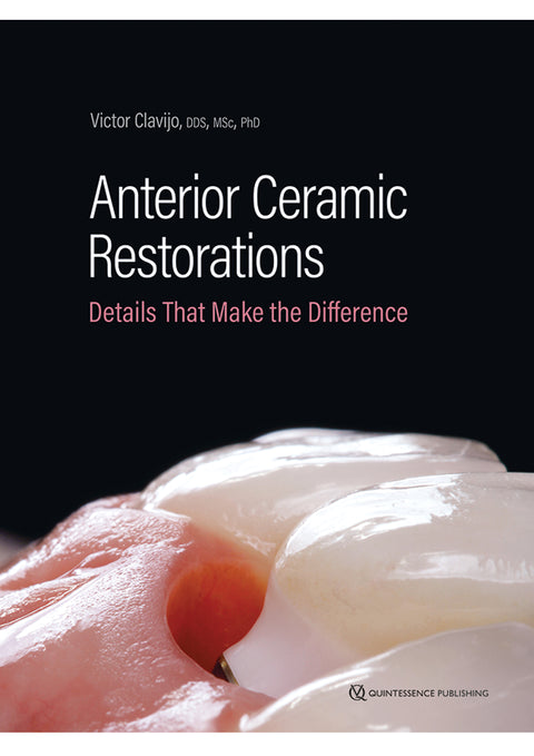 Anterior Ceramic Restorations - Details That Make the Difference