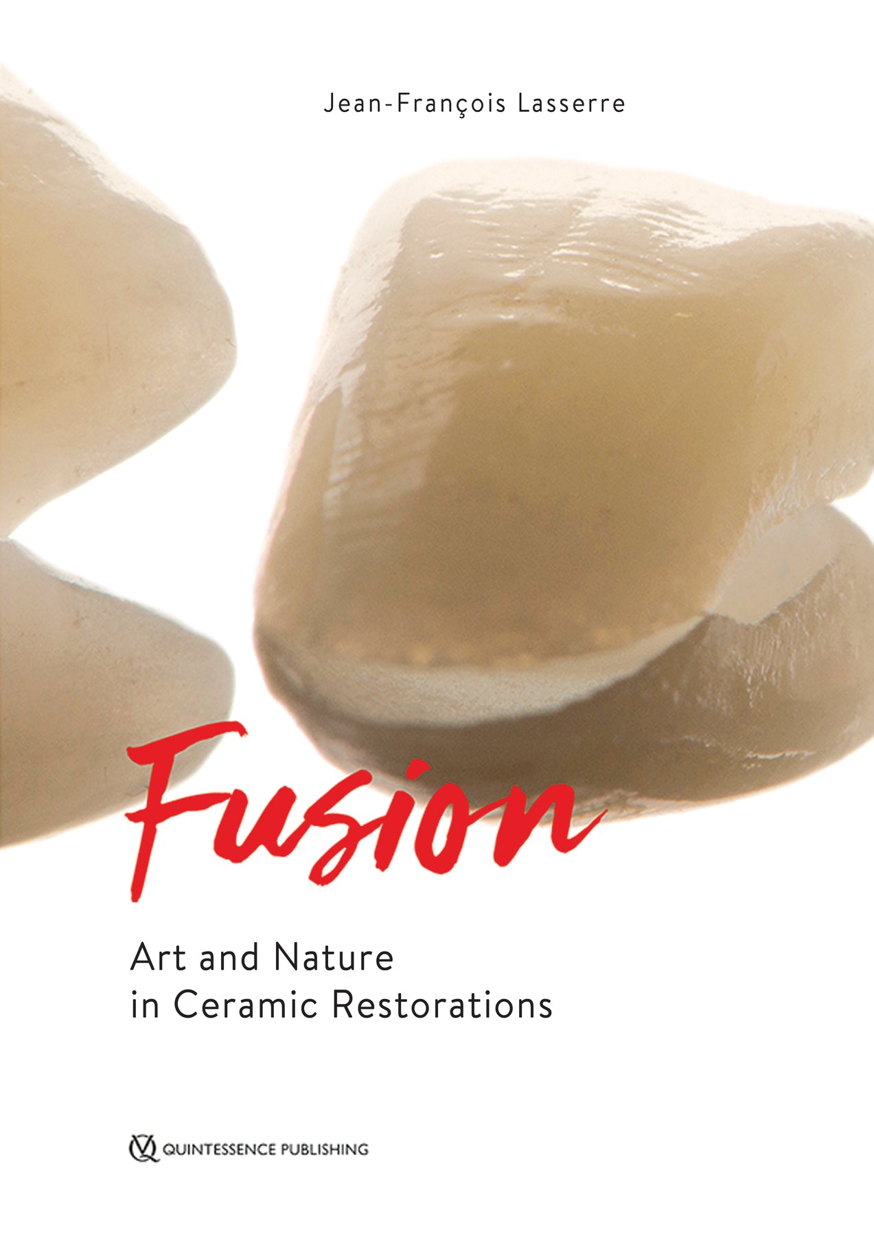 Fusion Art and Nature in Ceramic Restorations – Mi-tec Medical Publishing