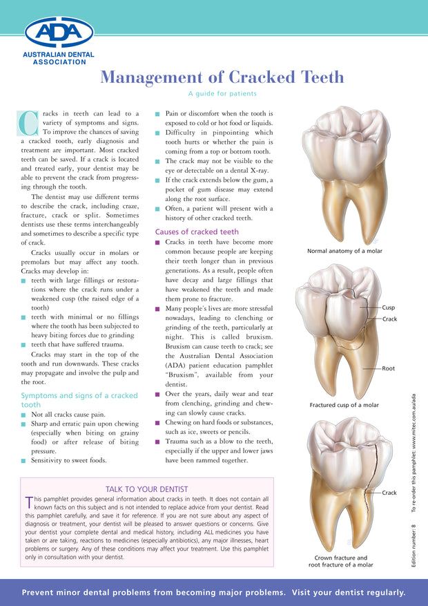 Management of Cracked Teeth