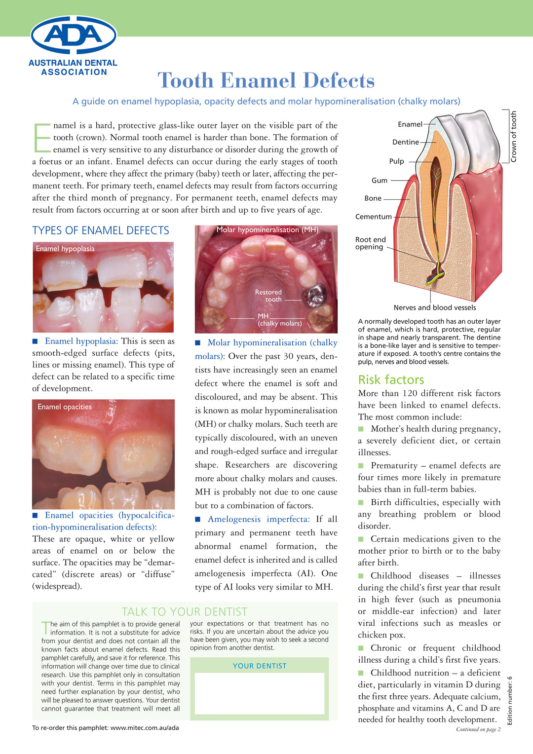 Missing Teeth Enamel Smile Gallery Before And After Dental Photos