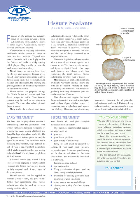 Fissure Sealants