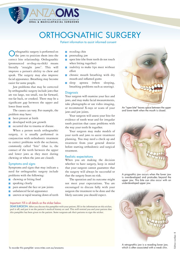 Orthognathic Surgery