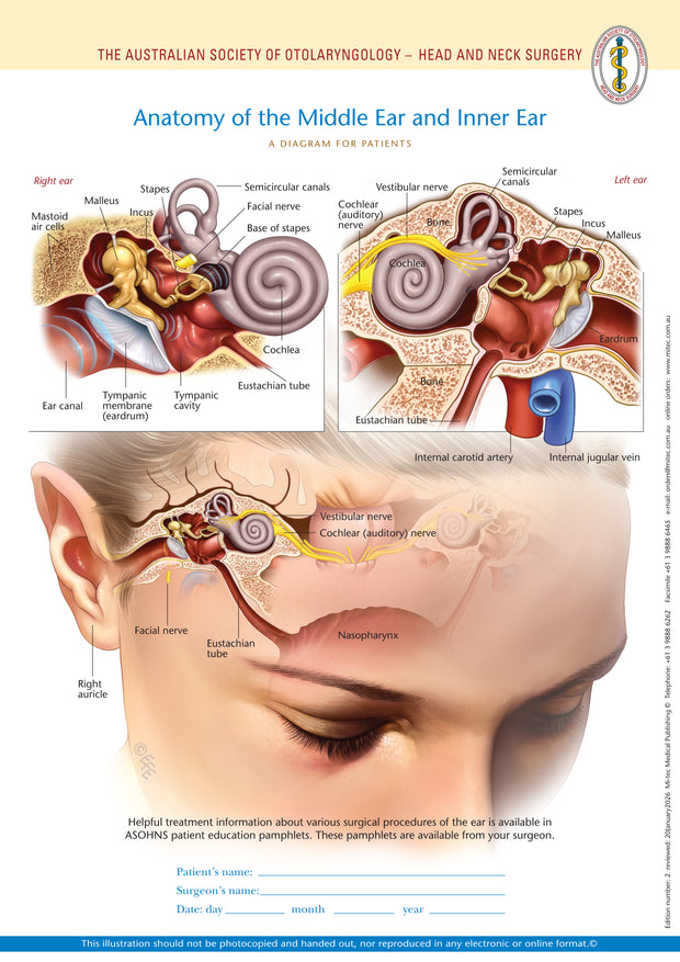 ASOHNS Patient Education Pamphlets | Mi-tec Medical – Mi-tec Medical ...
