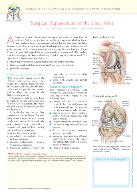 Surgical Replacement of the Knee Joint