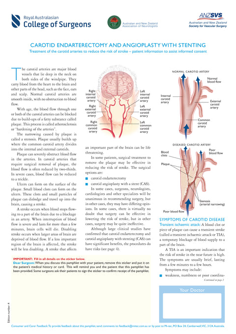 Carotid Endarterectomy