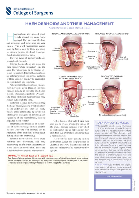 Haemorrhoids and their Management
