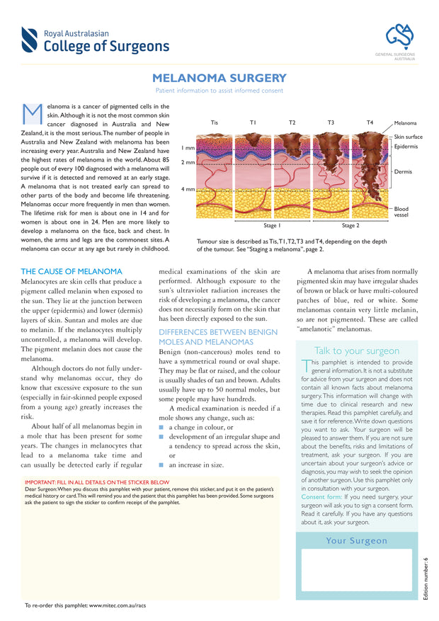 Melanoma Surgery (RACS)