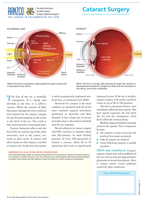 Cataract Surgery