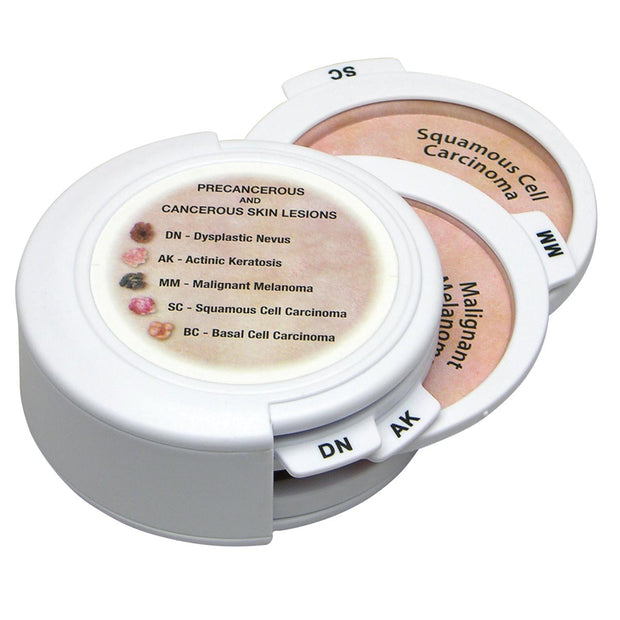 Skin Cancer Disk Set