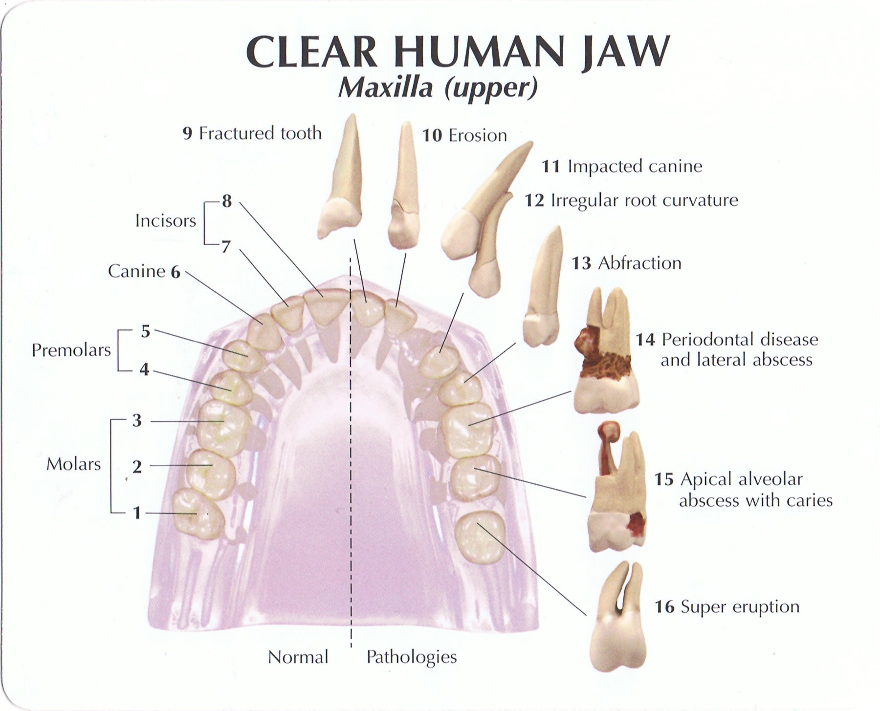 Tooth In Jaw Clear Human Jaw With Teeth - Anatomical Models for Dentists – Mi-tec ...
