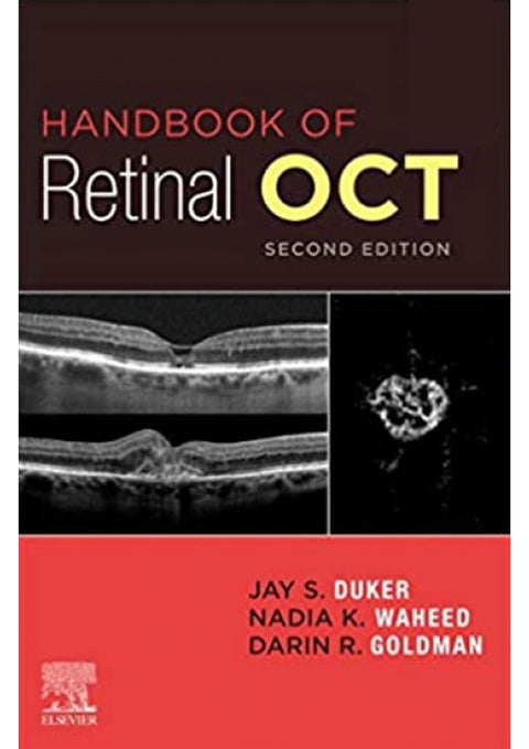 Handbook of Retinal OCT: Optical Coherence Tomography