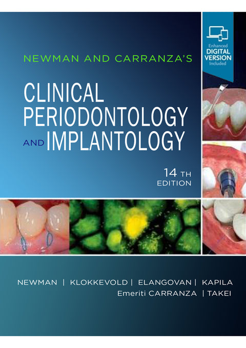 Newman and Carranza's Clinical Periodontology and Implantology 14th Edition