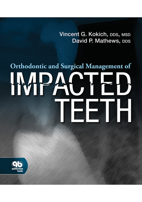 Orthodontic and Surgical Management of Impacted Teeth