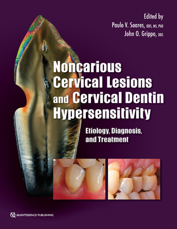 Noncarious Cervical Lesions and Cervical Dentin Hypersensitivity: Etiology, Diagnosis, and Treatment