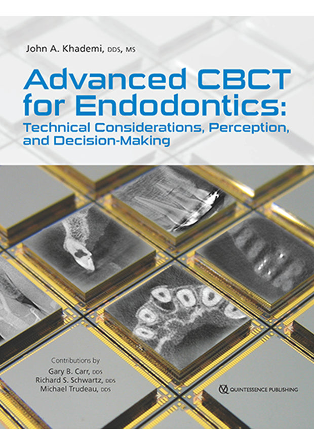 Advanced CBCT for Endodontics: Technical Considerations, Perception, and Decision-Making