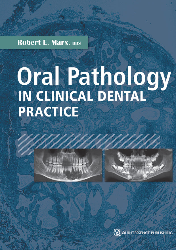 Oral Pathology in Clinical Dental Practice