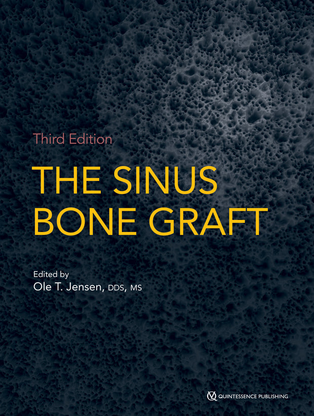 The Sinus Bone Graft, Third Edition