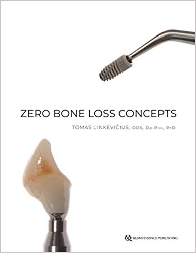 Zero Bone Loss Concepts