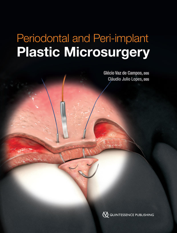 Periodontal and Peri-implant Plastic Microsurgery: Minimally Invasive Techniques with Maximum Precision
