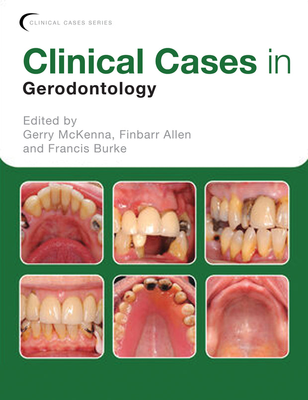 Clinical Cases in Gerodontology