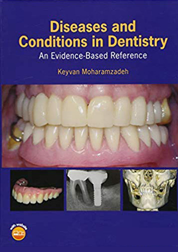 Diseases and conditions in dentistry: an evidence-based reference