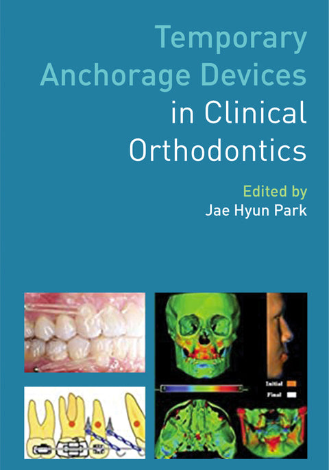 Temporary Anchorage Devices in Clinical Orthodontics