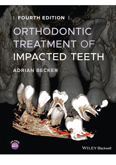 Orthodontic Treatment of Impacted Teeth - 4th edition