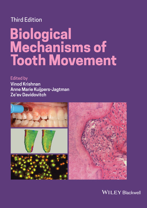 Biological Mechanisms of Tooth Movement