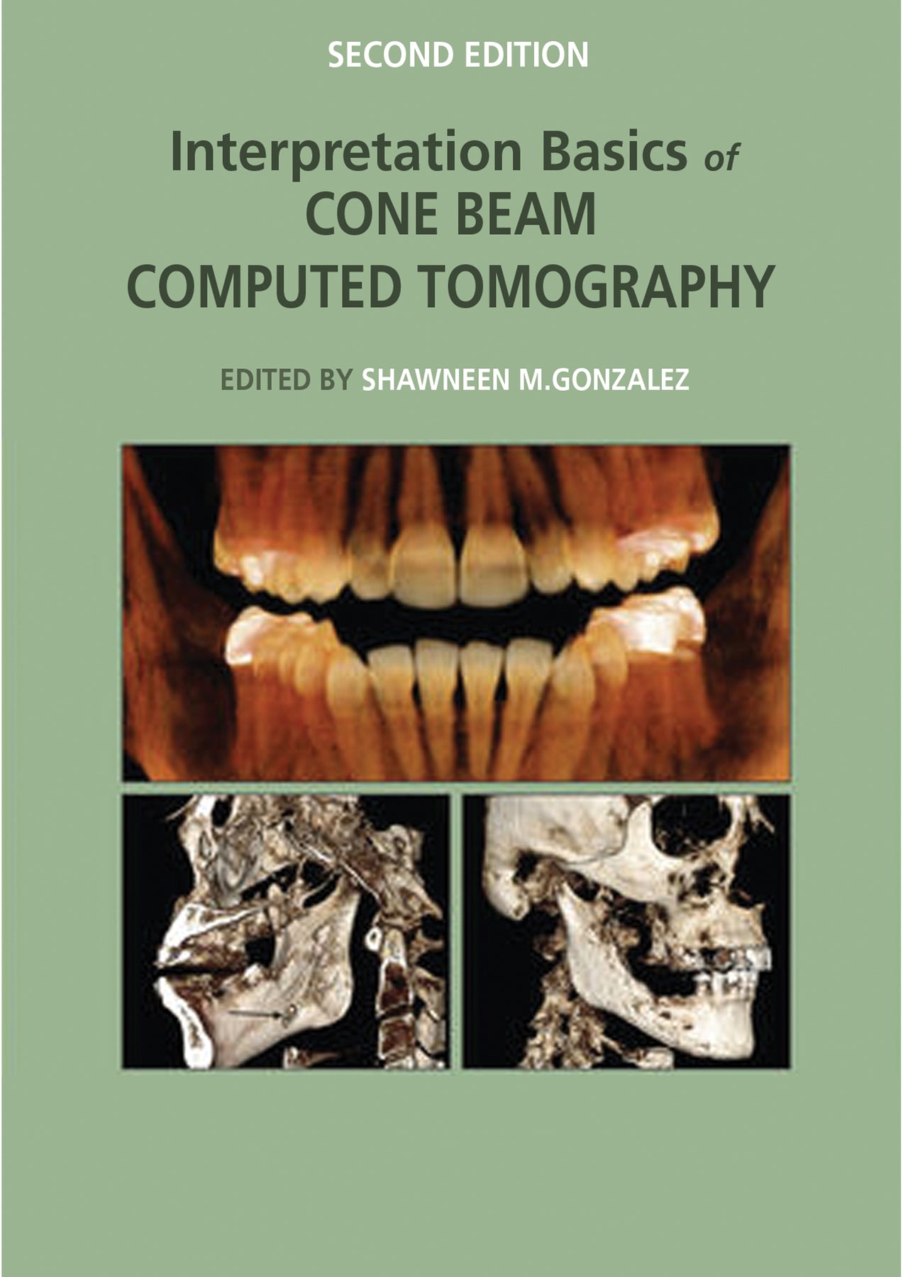 Interpretation Basics of Cone Beam Computed Tomography – Mi-tec Medical ...