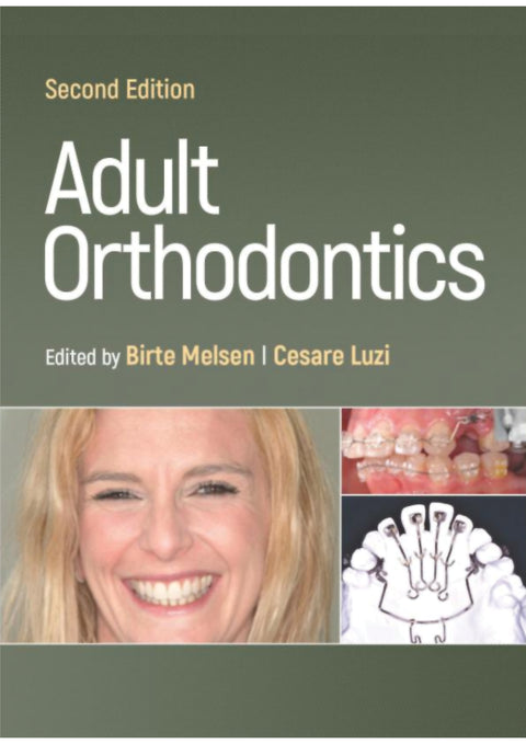 Adult Orthodontics, 2nd Edition