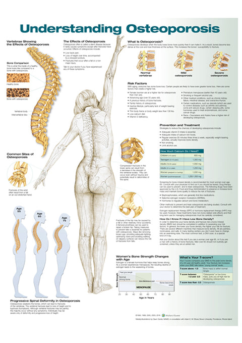 Understanding Osteoporosis