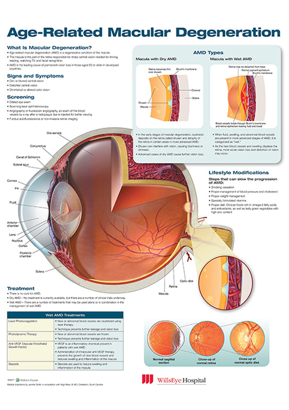 Age-Related Macular Degeneration
