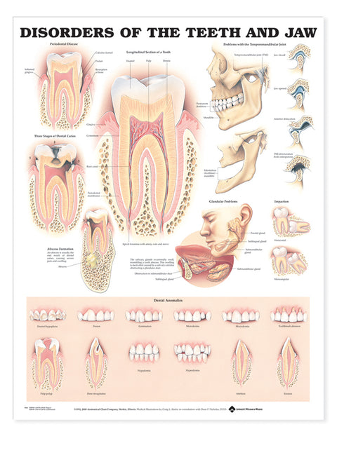 Disorders of the Teeth and Jaw (A2 Poster)