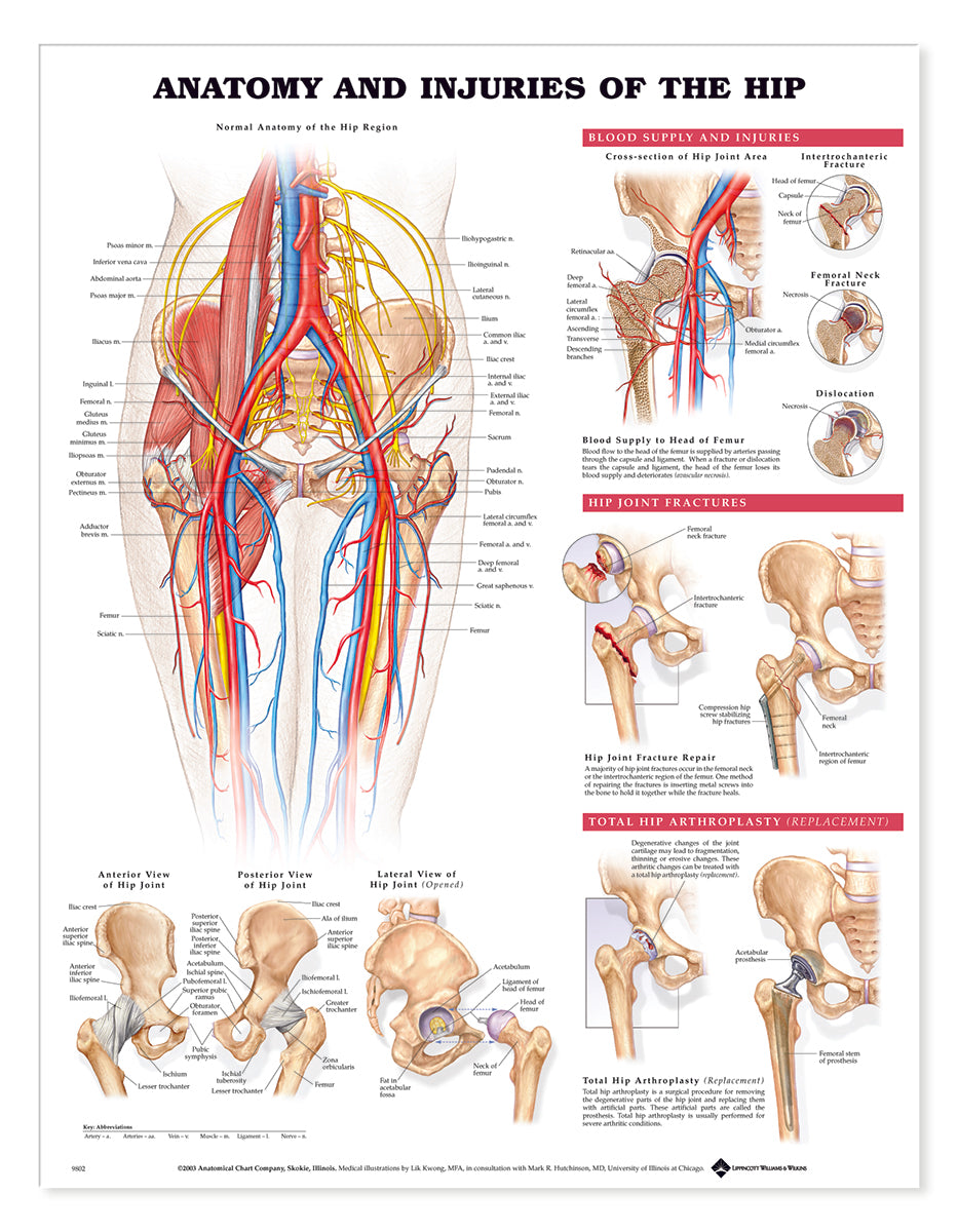 Femoral Artery Occlusion
