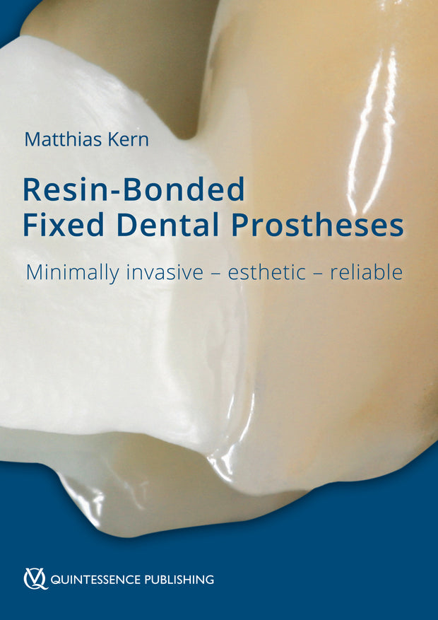 Resin-Bonded Fixed Dental Prostheses