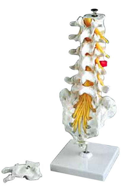 Flexible Lumbar Vertebral Column with Herniated Disc