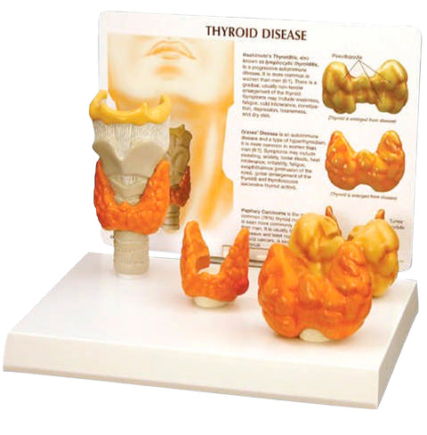 Thyroid Disease Model
