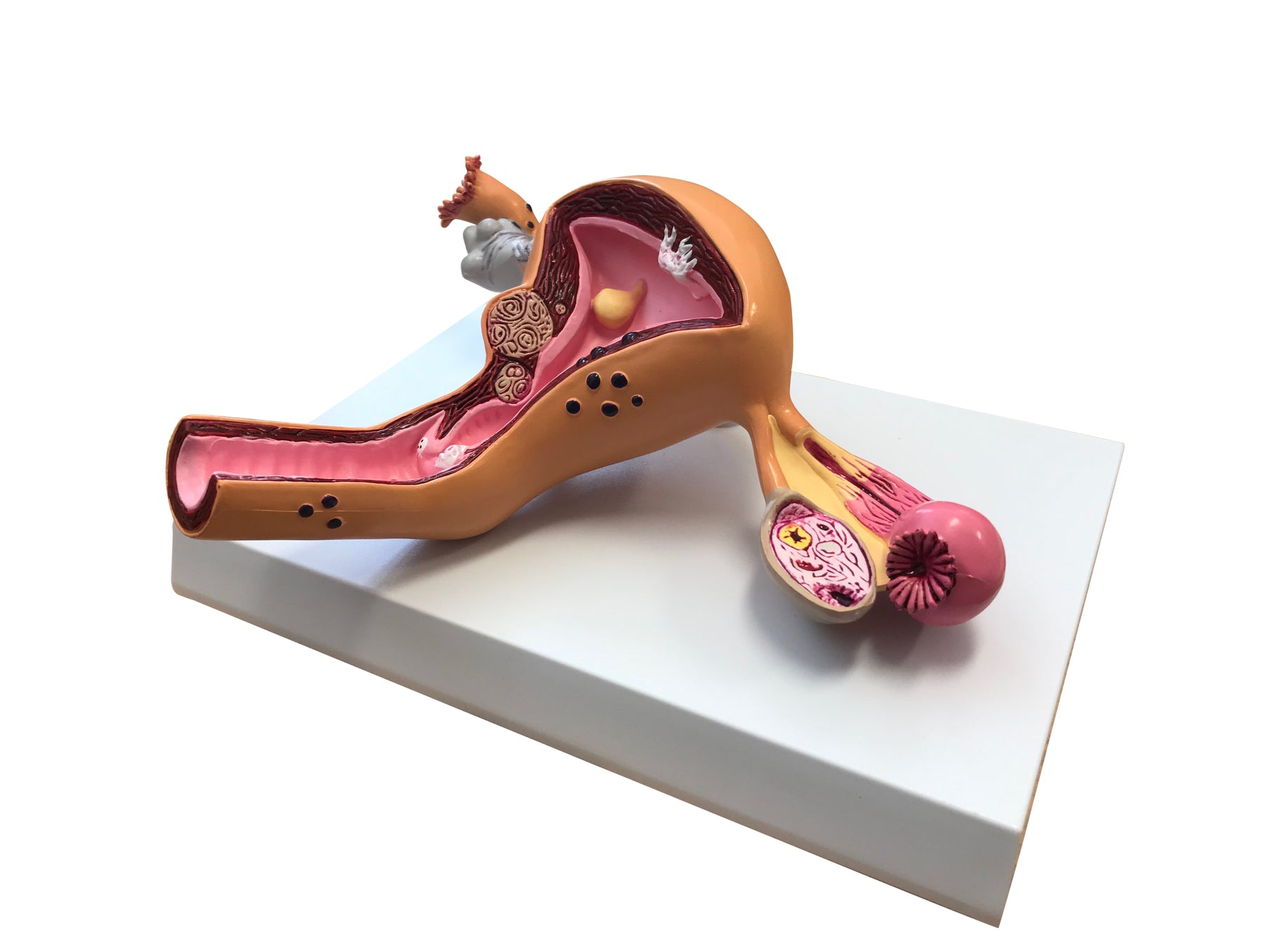 Obstetric & Gynaecological Anatomical Models – Mi-tec Medical Publishing