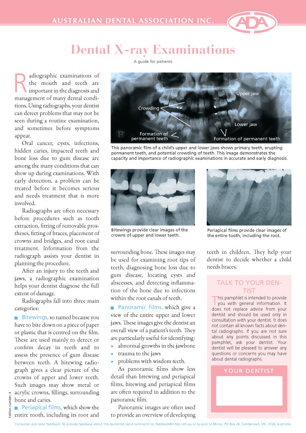 Dental X-Ray Examination