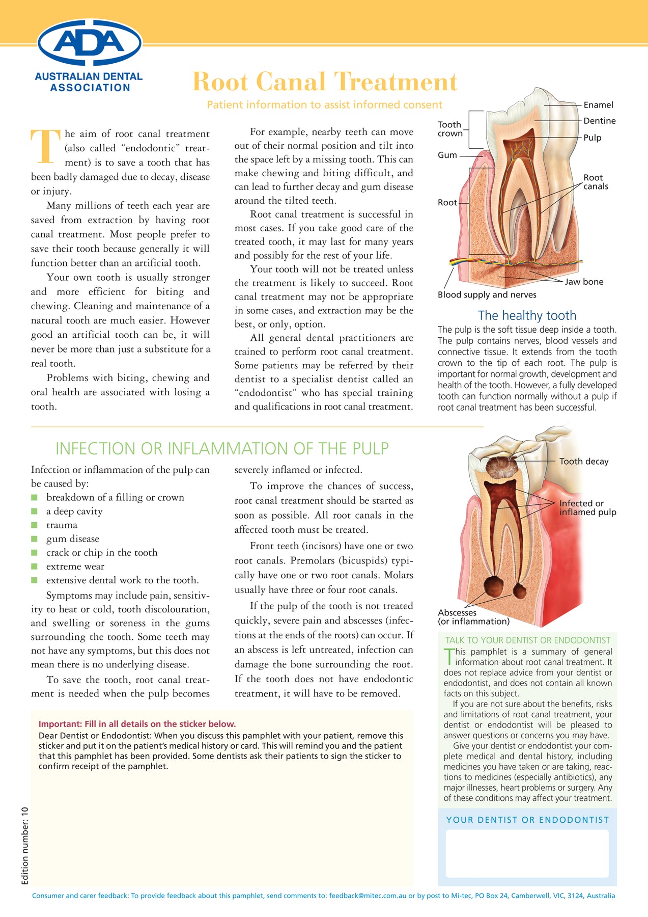 Root Canal Treatment Mitec Medical Publishing