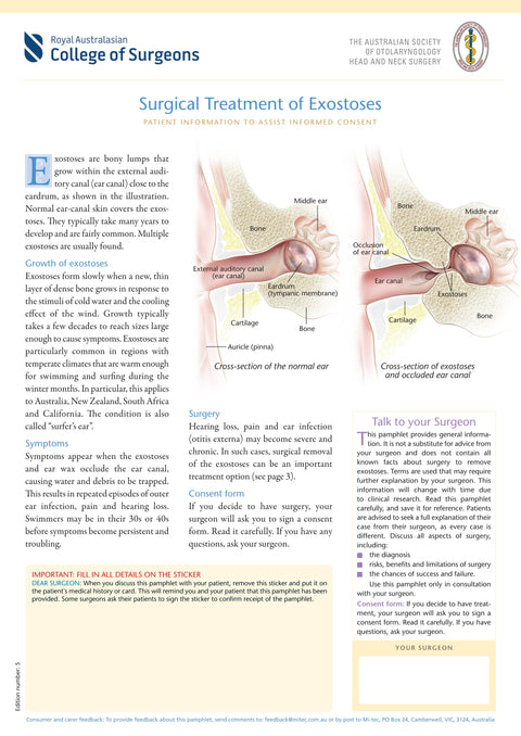 Surgical Treatment of Exostoses