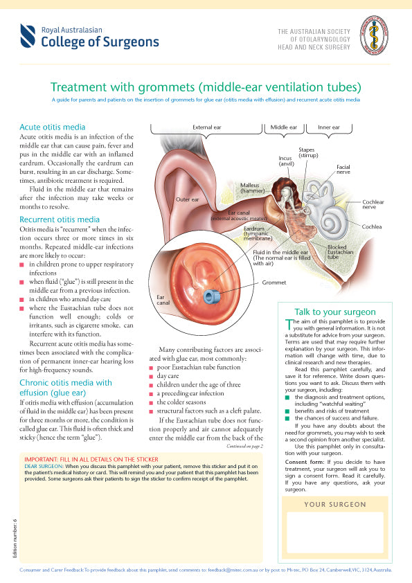 Treatment with Grommets (middleear ventilation tubes) Mitec Medical