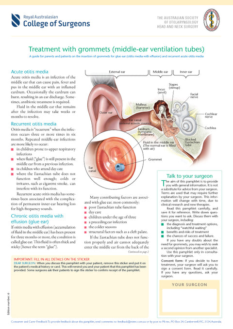Treatment with Grommets (middle-ear ventilation tubes)
