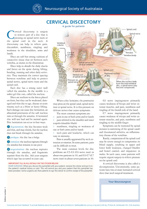 Cervical Discectomy