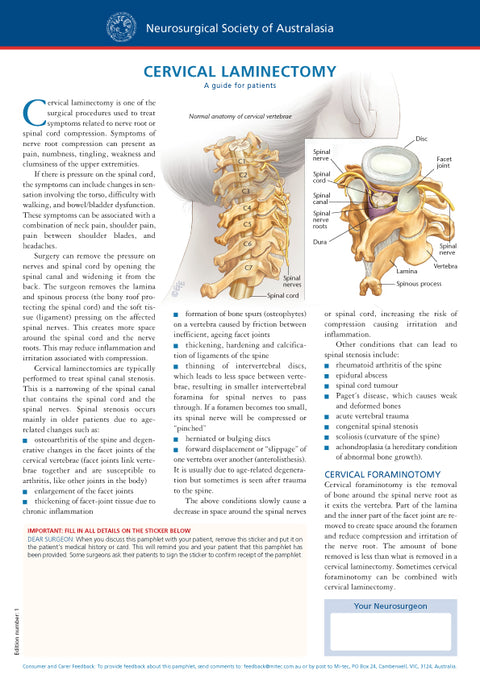 Cervical Laminectomy